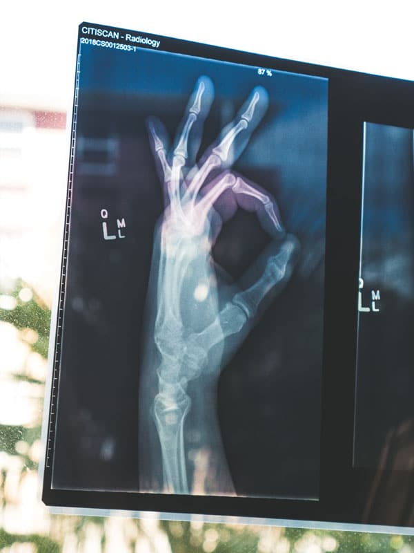 Deep Learning : la révolution indispensable pour votre business